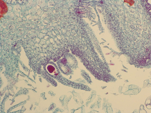Liverwort Archegonia CS Slides - Liverwort Archegonia CS 02 200X